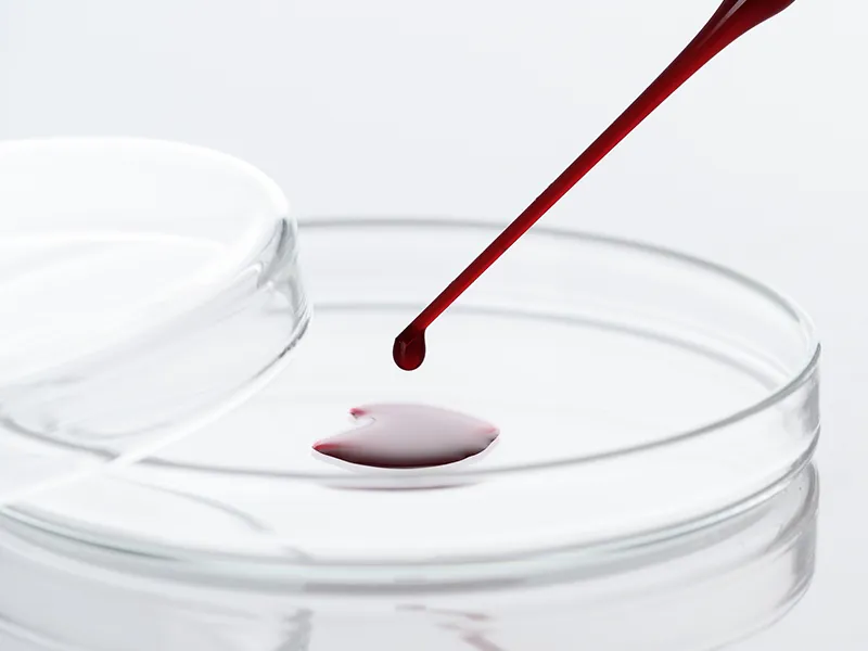 シャーレに滴下された血液