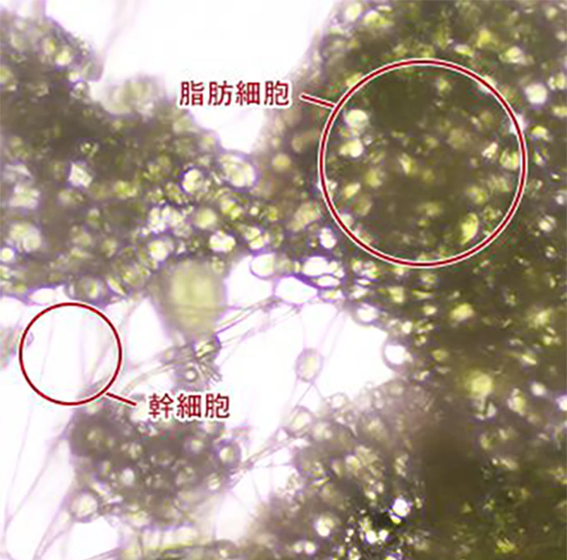 脂肪細胞と幹細胞を顕微鏡で観察した図