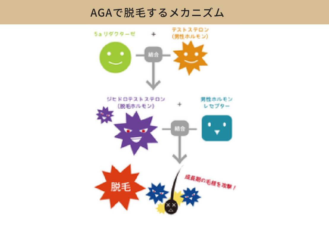 DHTが毛根に作用してAGAによる脱毛が起こるメカニズムの図解