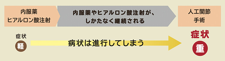 従来の治療では変形性関節症の症状が進行してしまうことを示す図解