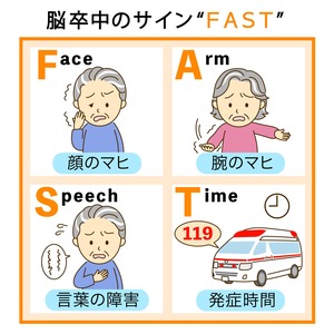 脳卒中のＦＡＳＴチェック